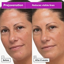 Dr. Jart+ Prejuvenation™ Firming Bakuchiol Cream - First Signs Of Ageing 50ml Dr. Jart+ Prejuvenation™ Firming Bakuchiol Cream - First Signs Of Ageing 50ml