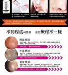 Blackhead Removal Activated Carbon Mask Set - 3 pcs