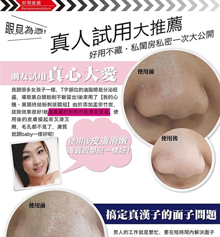 Blackhead Removal Activated Carbon Mask Set - 3 pcs