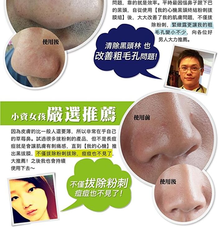 Blackhead Removal Activated Carbon Mask Set - 3 pcs