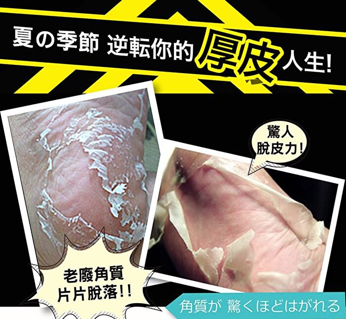 Hard Skin Removal Black Foot Mask - 1 pair