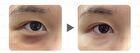 Dark Circle Removal Golden Eye Mask - 30 pairs