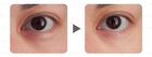 Dark Circle Removal Golden Eye Mask - 30 pairs