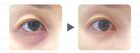 Dark Circle Removal Golden Eye Mask - 30 pairs