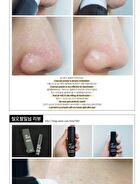 All Kill Blackhead Remover Stick - 10g