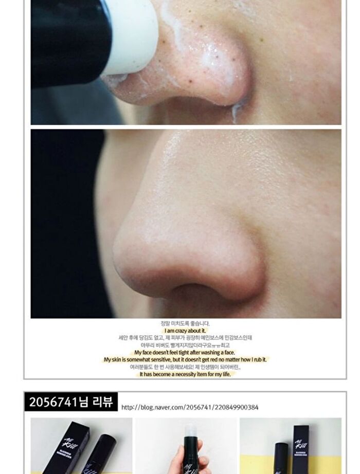 All Kill Blackhead Remover Stick - 10g