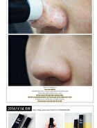 All Kill Blackhead Remover Stick - 10g
