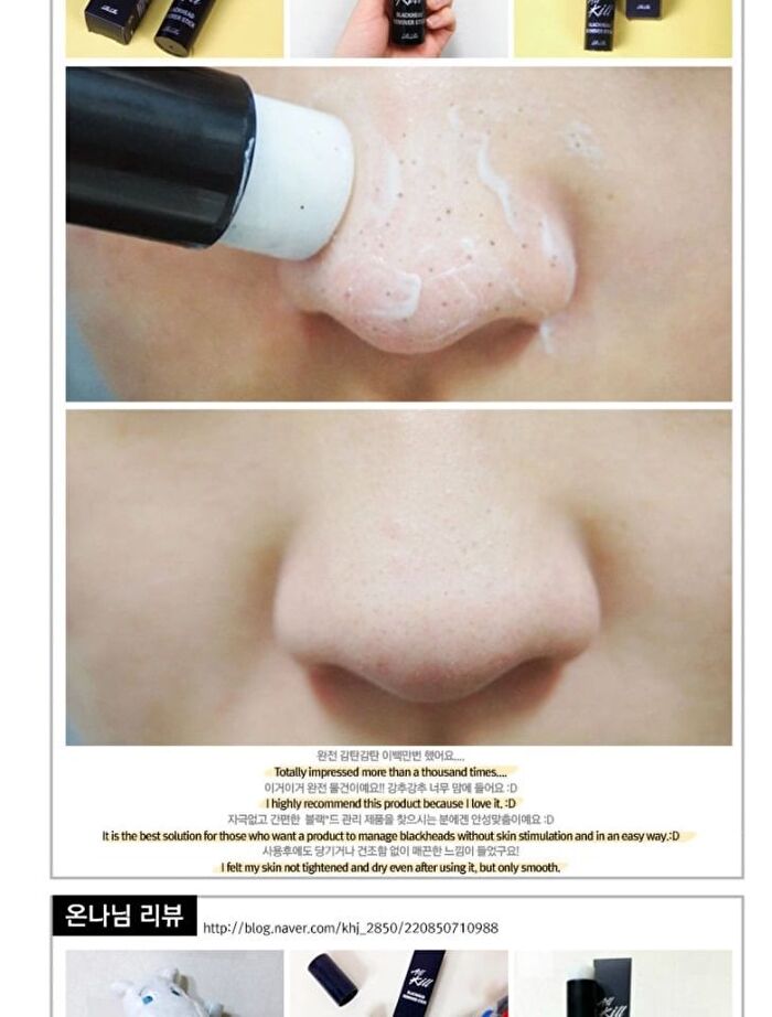 All Kill Blackhead Remover Stick - 10g
