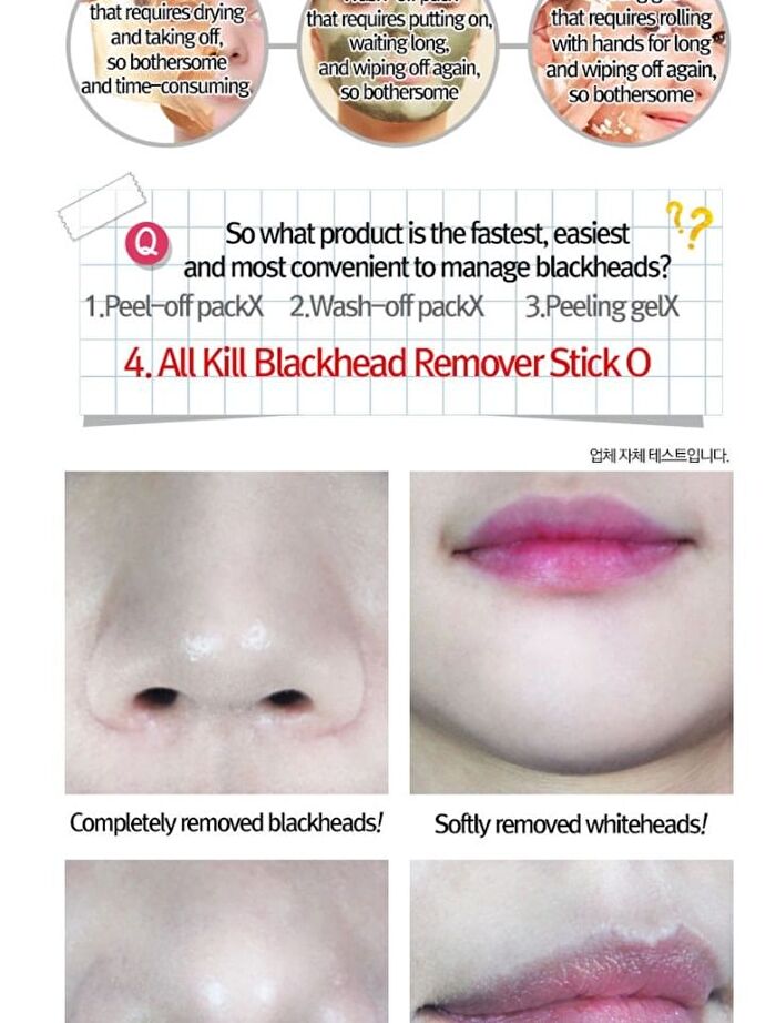 All Kill Blackhead Remover Stick - 10g