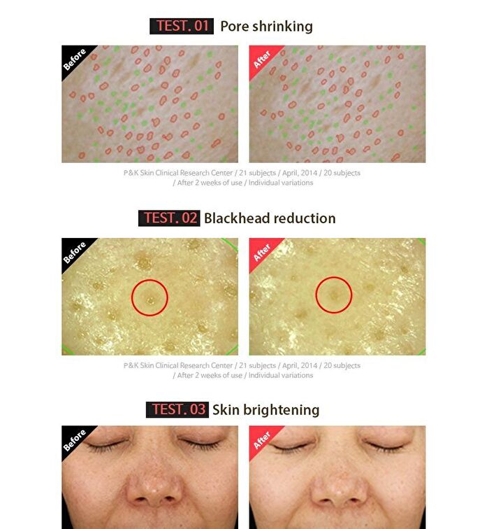 Maxclinic Rose Vitamin Oil Foam - 110g