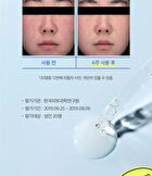 Dr. Belmeur Clarifying Spot Care Ampoule - 22ml
