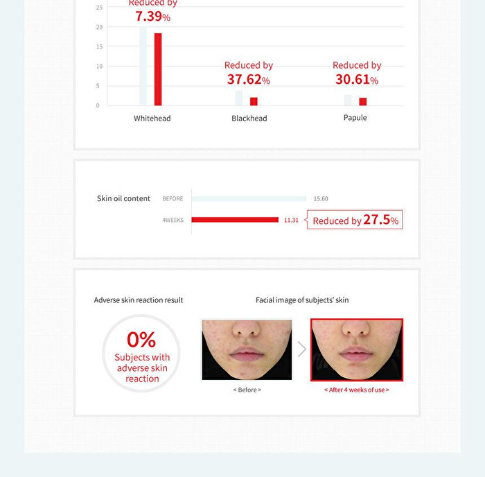 Red Spot Cica Sulfur Gel - 20ml