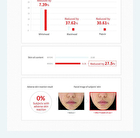 Red Spot Cica Sulfur Gel - 20ml