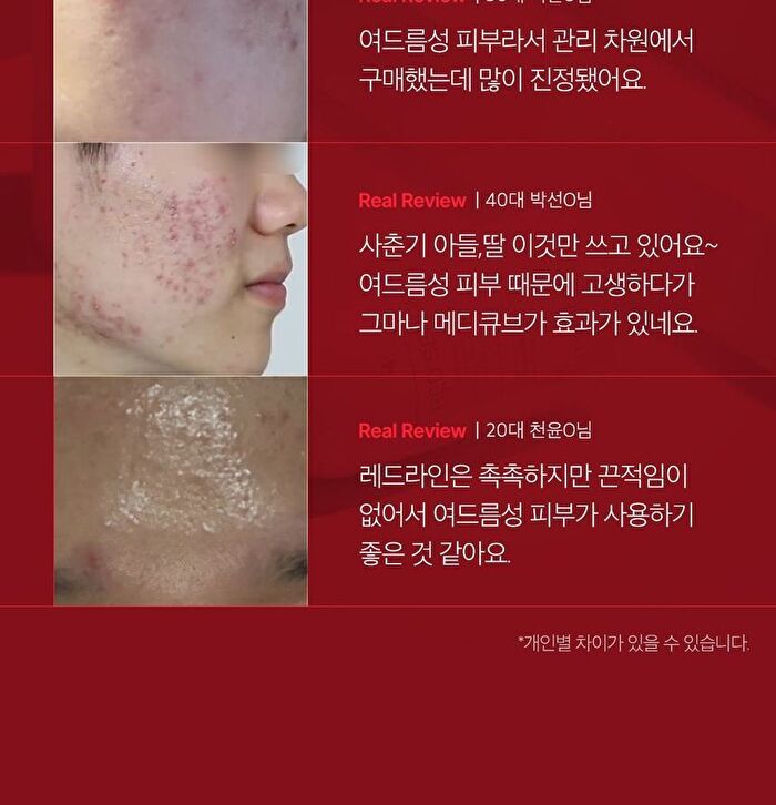 Red Serum 2.0 - 30ml