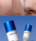 Zero Pore Serum 2.0 - 37ml