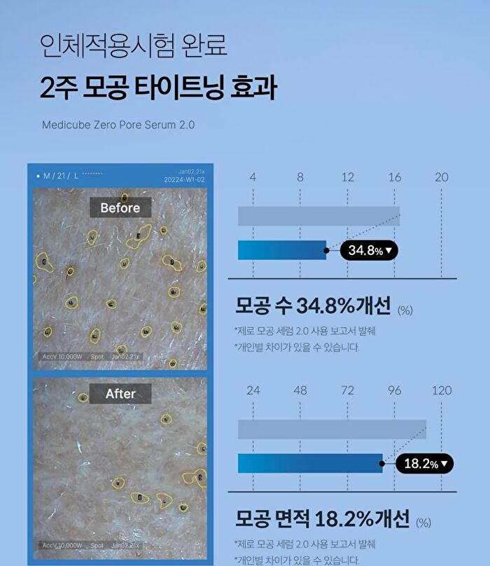 Zero Pore Serum 2.0 - 37ml