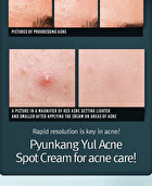 Acne Spot Cream - 15ml