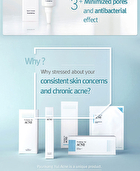 Acne Spot Cream - 15ml