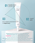 Acne Spot Cream - 15ml