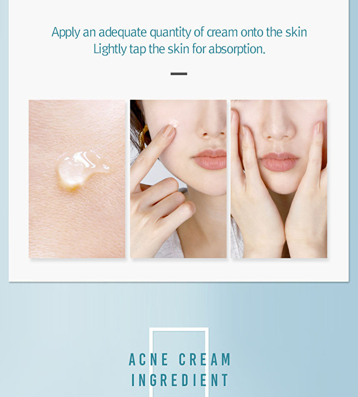 Acne Cream - 50ml