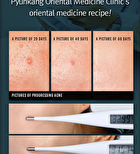 Acne Dressing Mask Pack - 18g x 1 sheet