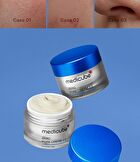 Zero Pore Cream 2.0 - 50ml