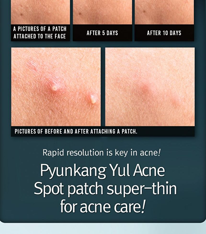 Acne Spot Patch Super Thin - 15  pcs