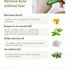 Sofnon Tsaio Tea Tree Control Acne Gel - 20g