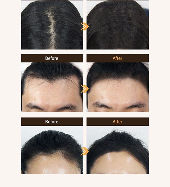 Quick Hair Cushion - 2 Colors - Natural Black