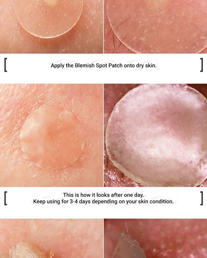 Witch Piggy Hell Pore Blemish Spot Patch - 2 pcs