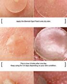 Witch Piggy Hell Pore Blemish Spot Patch - 2 pcs