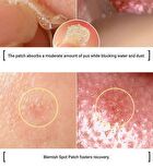 Witch Piggy Hell Pore Blemish Spot Patch - 2 pcs
