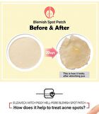 Witch Piggy Hell Pore Blemish Spot Patch - 2 pcs