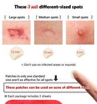 Witch Piggy Hell Pore Blemish Spot Patch - 2 pcs