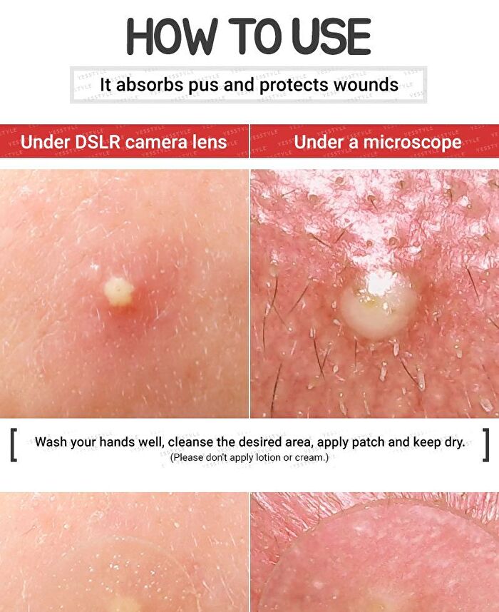 Witch Piggy Hell Pore Blemish Spot Patch - 2 pcs