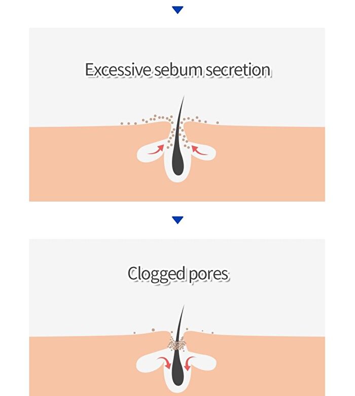 Isoi ACNI Dr. 1st Speedy Mask Set - 20ml x 10 pcs