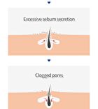 Isoi ACNI Dr. 1st Speedy Mask Set - 20ml x 10 pcs