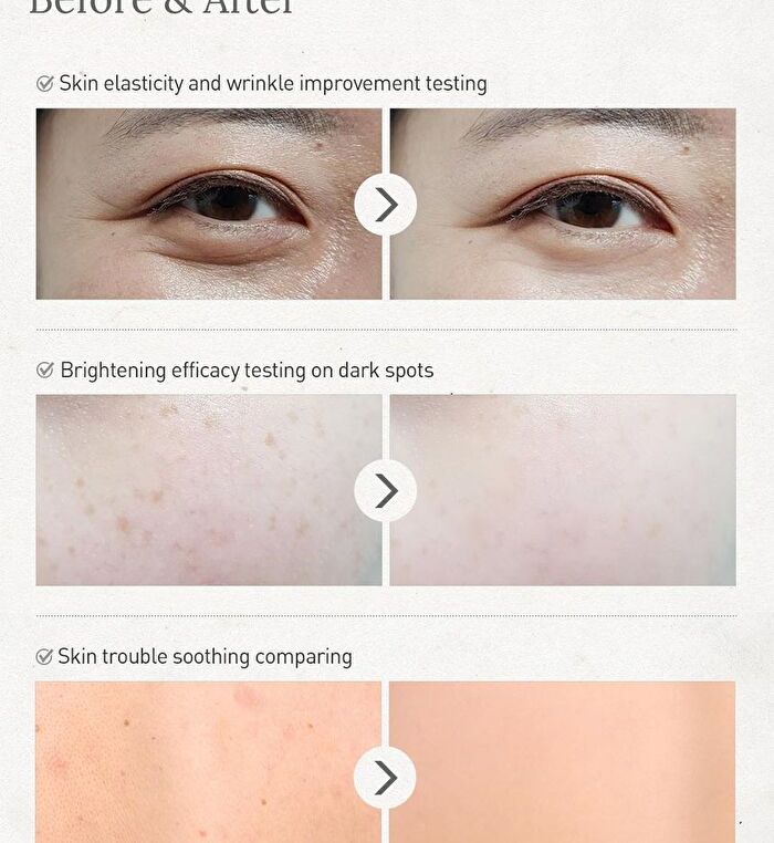 Real Soothing Gel - 2 Types - #02 Snow Mushroom
