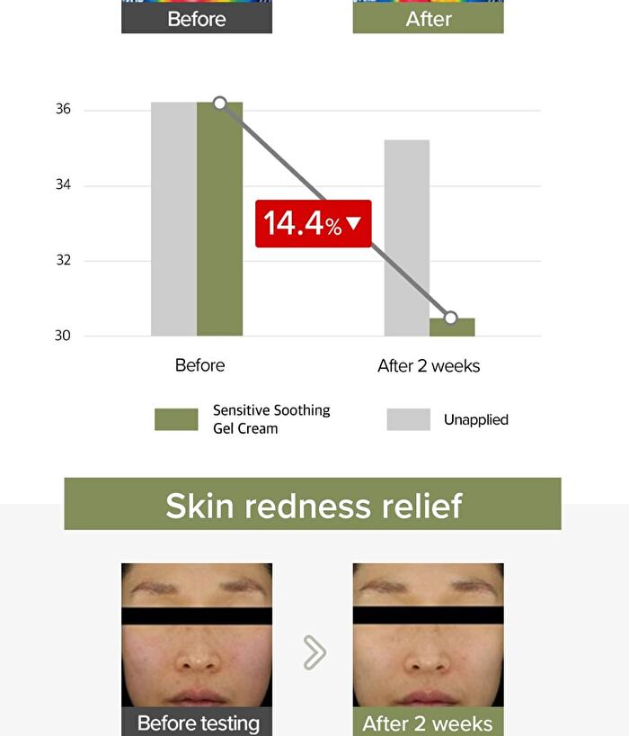 Sensitive Soothing Gel Cream - 70g
