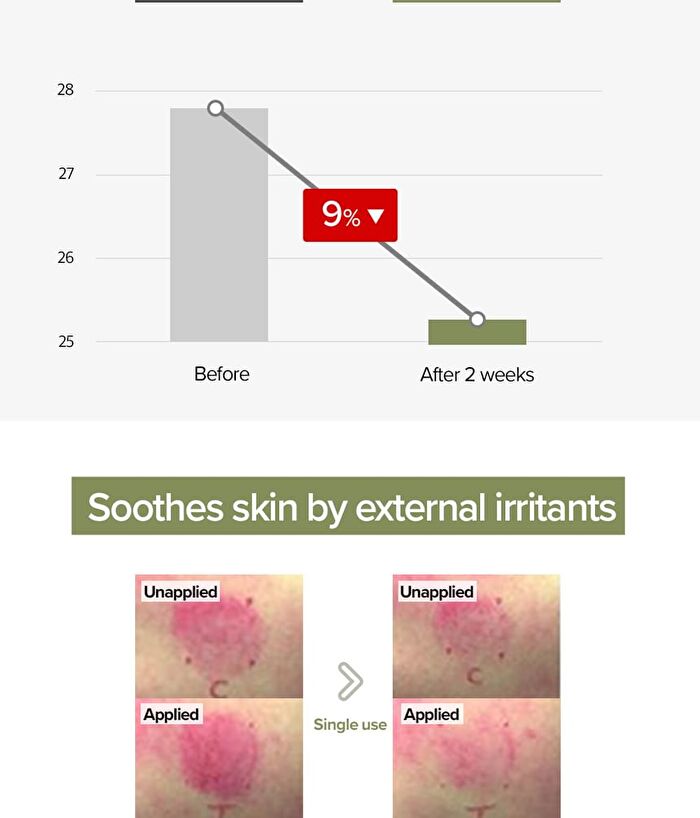 Sensitive Soothing Gel Cream - 70g