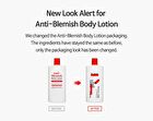 Tia\'m Anti Blemish Body Lotion Back & Chest - Renewed: 200ml