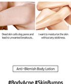 Tia\'m Anti Blemish Body Lotion Back & Chest - Renewed: 200ml