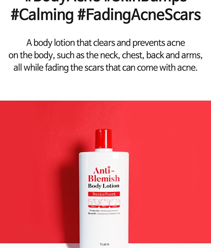 Tia\'m Anti Blemish Body Lotion Back & Chest - Renewed: 200ml