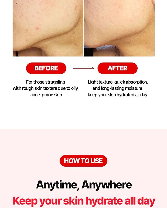 AC Oil-Free Hydrating Jelly - 80ml