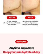 AC Oil-Free Hydrating Jelly - 80ml