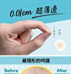 Day Use Acne Patch 24 pcs - 12 pcs x 2