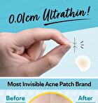 Day Use Acne Patch 24 pcs - 12 pcs x 2