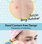 Day Use Acne Patch 24 pcs - 12 pcs x 2