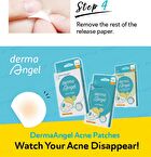 Day Use Acne Patch 24 pcs - 12 pcs x 2