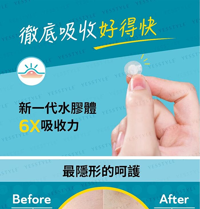 Night Use Acne Patch 24 pcs - 12 pcs x 2